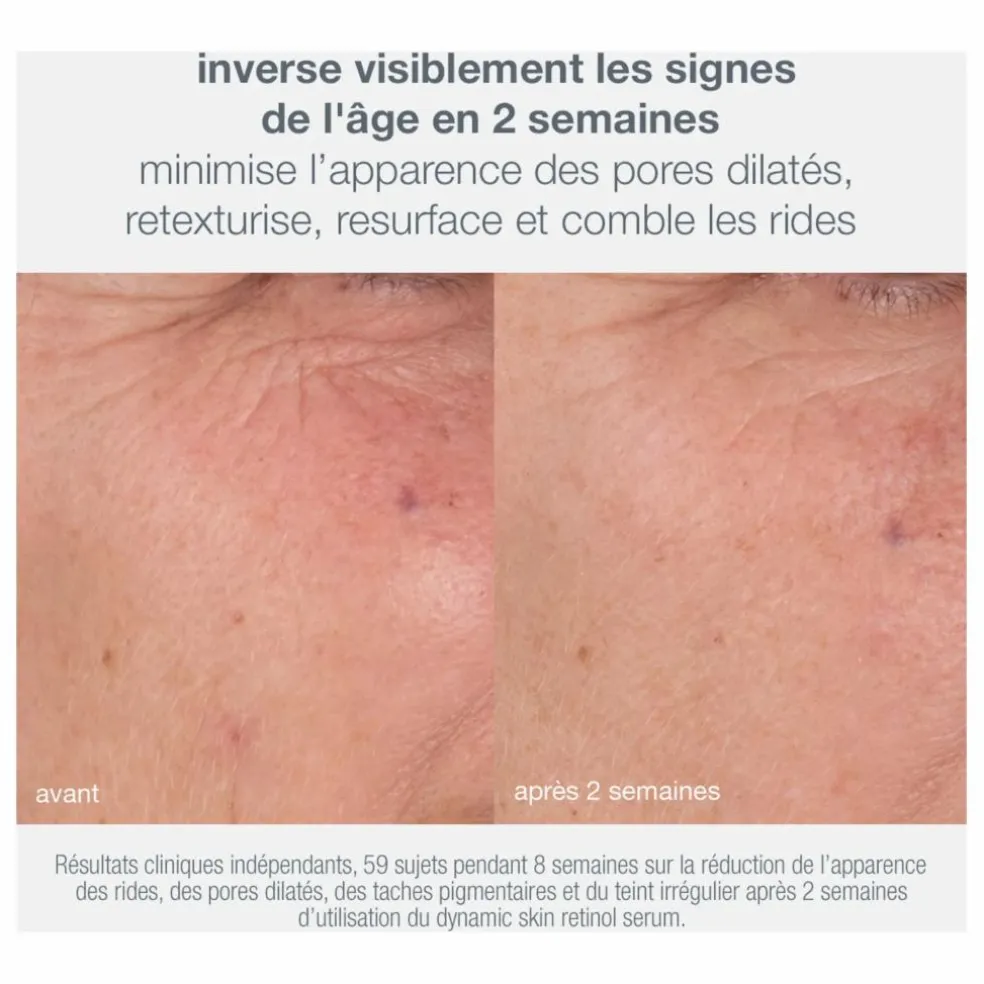 Coffret anti-âge et fermeté